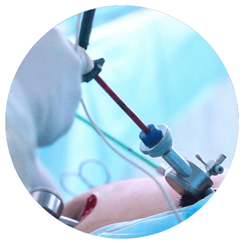 Modern laparoscopic surgery